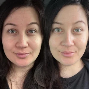 Community skincare image