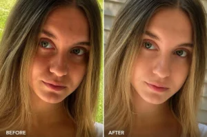 Community skincare image