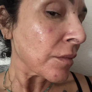 Community skincare image